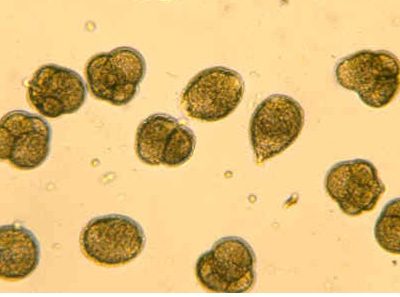 Developing oyster eggs.